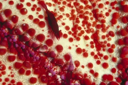 A microscope view of densely packed red cells.